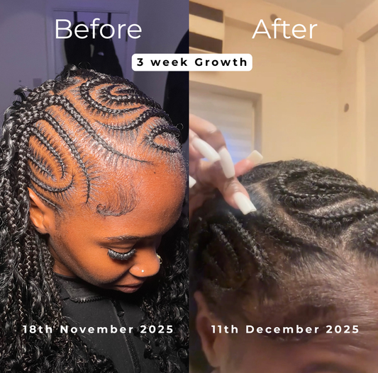 Growth Stimulating Oil